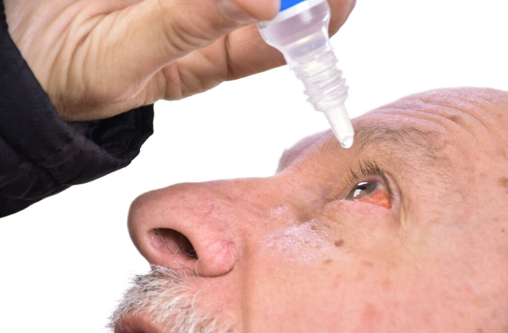 An elderly man is using eye drops to treat his dry eyes. Optilight is another effective intense pulsed light therapy for relieving dry eye symptoms.